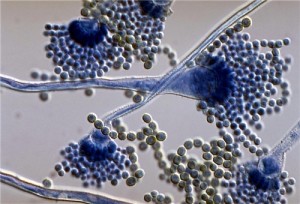 nanobiosensor